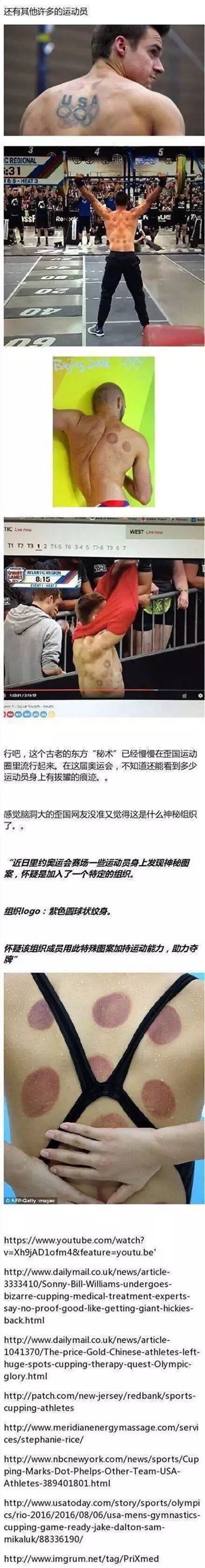 美国游泳队拔火罐_美国游泳冠军拔火罐_外国选手拔罐